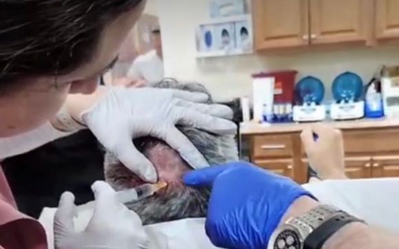 Hairloss treatments with exosomes and prp by Sage Wellness and Medspa