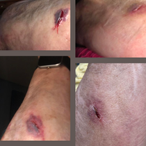 Check out our line of wound care products!  by LastGerm.com