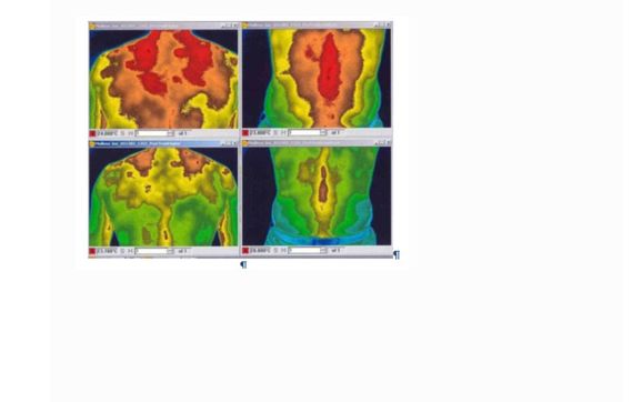 Affordable Light Therapy 4 You by Joe Torres