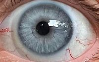Iridology  by Good News Health Solutions
