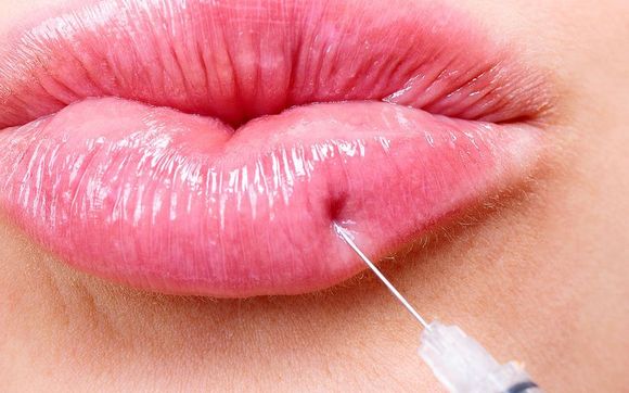 Dermal Fillers by Worth It Beauty & Wellness