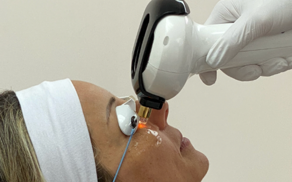 Inmode Lumecca IPL and Forma-i RF advanced dry eye treatment by Van Alstyne Eyecare