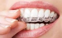 Invisalign by Mega Bite Dental - Mojgan Shokri, DDS