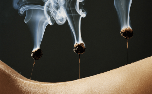 Moxibustion by Organic Palms Massage & Reiki