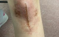 Prosthetic trauma makeup by DimensionXstudios