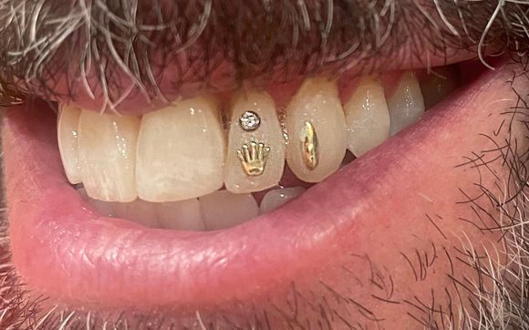 Bling Your Grill. by Sugar Fang Tooth Gems in Los Angeles, CA