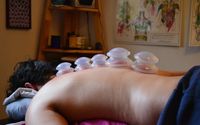 Cupping Massage by Leilani Massage