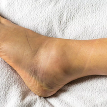 Sports Injuries by Align Foot and Ankle Center