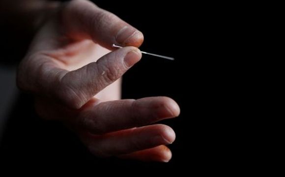 Traditional acupuncture by flourish acupuncture