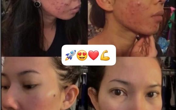 #1 Korean skincare by Rimanlulus