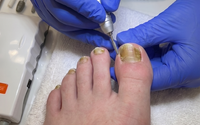 Nail trimming and filing by Happy Foot Care