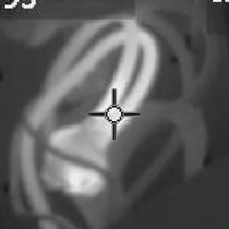 Thermal Imaging by High Tech Inspections Inc.