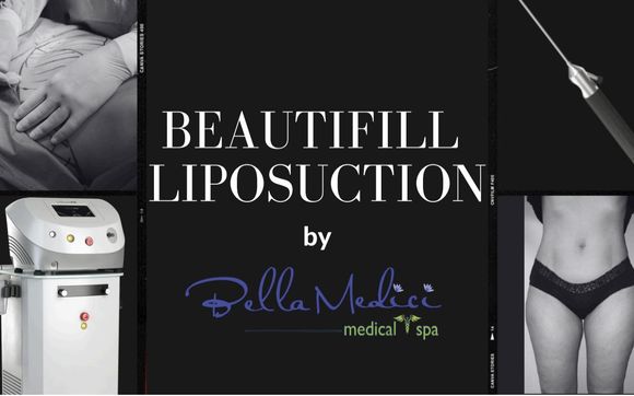 Beutifill Laser-Assisted Liposuction and Beautifirm Skin Tightening by Bella Medici Medical Spa