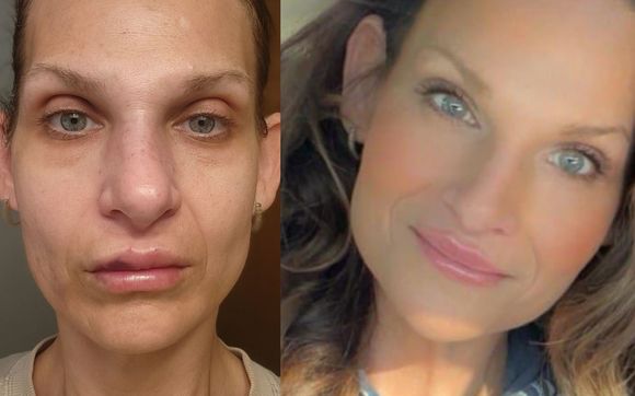 Facial balancing! by BBeautiful Collective