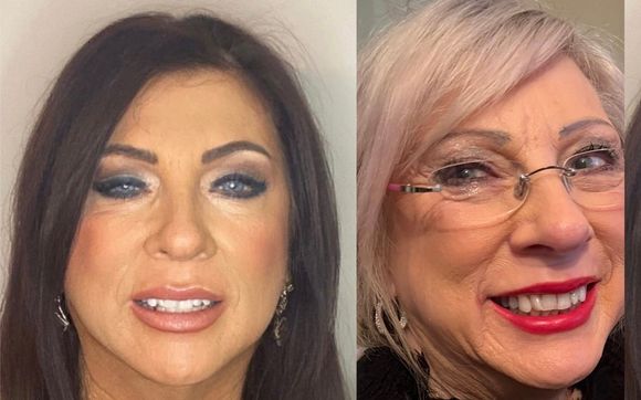 Non surgical face lift by BBeautiful Collective