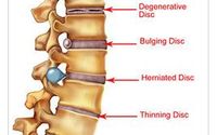 Pain Management by Surfside Chiropractic Center