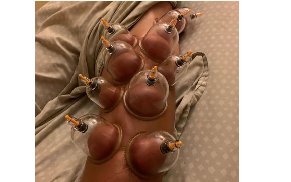 Posture and Muscle Balancing & Correction by Corporate Massage Therapies-Advanced Treatment Center LL