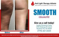 Trust your Gut Weight loss ? RED LIGHT THERAPY by Fayette Chiropractic Center REd Light therapy Atlanta