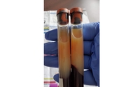                         Cholesterol testing  by Arizona Mobile Phlebotomy Services