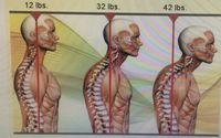 Chiropractor  by Care family Medical