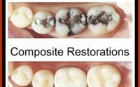 complete teeth restorations and cosmetics by New York Ave Dental PC