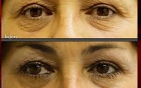 PRP by The Vein Doctor Medical Group