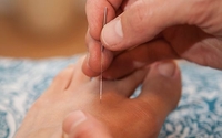 Acupuncture by Timothy Asher, Acupuncture & Wellness