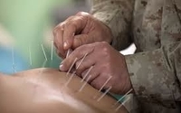 Free 15 minutes consultation and 20%discount on acupuncture sessions by Ontario Naturopathic Clinic