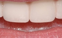 High-tech General Dentistry for ultimate patient comfort! by LaserSmileStudio.com