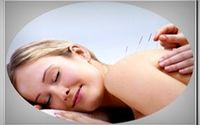 Traditional Chinese Medicine: Acupuncture & herbs by Tustin Medical Art Center Xu's Acupuncture
