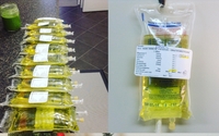 Intravenous (IV) Therapy by Dr. Shelby Worts, BSc, ND
