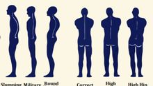Postural Analysis by Therapeutic Muscle Sculpting & Massage