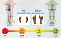 Custom Foot Orthotics by Advance Chiropractic & Health Center
