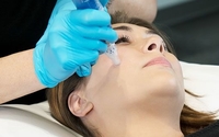 Microneedling by Xage Medical Spa