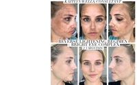 Reverse Lightening Regimen by Rodan + Fields- Shawnda Boysel