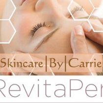 RevitaPen Nano Infusion Anti Aging Facial by Skincare By Carrie
