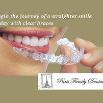 Invisalign by Paris Family Dental