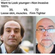 John Aslanian from Precision Aesthetics MD