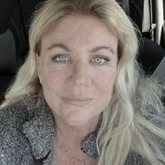 Janette Archer from The Micropigment Studio Scalp Micropigmentation Procedure (SMP)                                                                                                      Hair Replacement